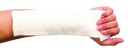Performance Splinting®Padded Fiberglass Splint